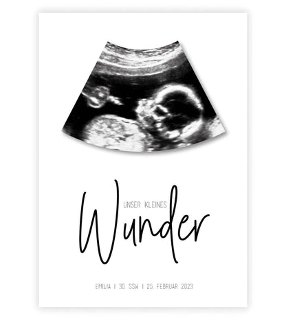 Personalisiertes Bild "Ultraschall Schwangerschaft", Bildfarbe: Weiß, Bildgröße: 13x18cm, DIN A4, DIN A3, Bilderrahmen: Ohne Bilderrahmen, Copyright:321geschenke.de